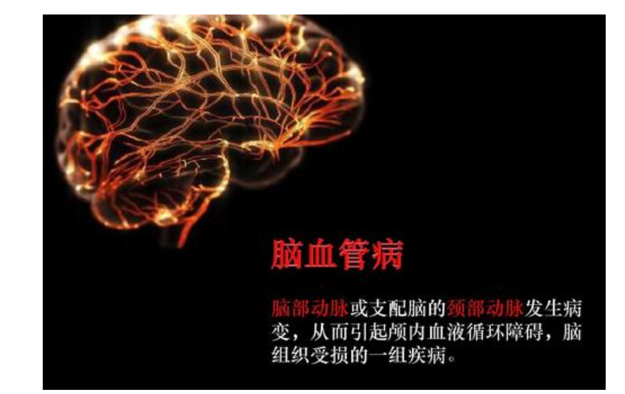 維生素D與神經(jīng)系統疾病相關(guān)性研究進(jìn)展